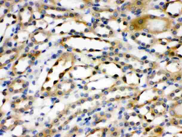 ACTN4 Antibody - Alpha Actinin 4 was detected in paraffin-embedded sections of rat kidney tissues using rabbit anti- Alpha Actinin 4 Antigen Affinity purified polyclonal antibody
