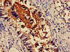 ACTN4 Antibody - Immunohistochemistry image of paraffin-embedded human lung tissue at a dilution of 1:100