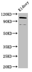 ACTN4 Antibody - Positive Western Blot detected in Mouse kidney tissue. All lanes: ACTN4 antibody at 3.4 µg/ml Secondary Goat polyclonal to rabbit IgG at 1/50000 dilution. Predicted band size: 105, 80, 60 KDa. Observed band size: 105, 80 KDa