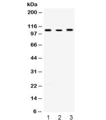 ACTN4 Antibody - Western blot testing of 1) rat liver, 2) mouse Neuro-2A and 3) human Raji lysate with ACTN4 antibody at 0.5ug/ml. Predicted/observed molecular weight ~105 kDa.