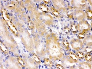 ACTN4 Antibody - IHC testing of FFPE mouse kidney with ACTN4 antibody at 1ug/ml. HIER: steam in pH6 citrate buffer and allow to cool prior to staining.