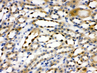 ACTN4 Antibody - IHC testing of FFPE rat kidney with ACTN4 antibody at 1ug/ml. HIER: steam in pH6 citrate buffer and allow to cool prior to staining.