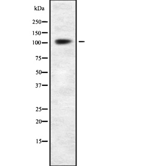 ACTN4 Antibody - Western blot analysis of ACTN4 using 293 whole cells lysates