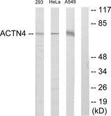 ACTN4 Antibody - Western blot analysis of extracts from 293 cells, HeLa cells and A549 cells, using ACTN4 antibody.