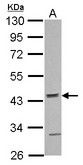ACTR10 Antibody - Sample (30 ug of whole cell lysate) A: NT2D1 10% SDS PAGE ACTR10 antibody diluted at 1:1000
