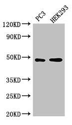 ACTR10 Antibody - Western Blot Positive WB detected in: PC-3 whole cell lysate, HEK293 whole cell lysate All lanes: ACTR10 antibody at 3µg/ml Secondary Goat polyclonal to rabbit IgG at 1/50000 dilution Predicted band size: 47 kDa Observed band size: 47 kDa