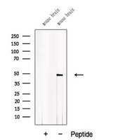 ACTR10 Antibody - Western blot analysis of extracts of C6 cells using ACTR10 antibody. The lane on the left was treated with blocking peptide.