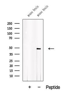ACTR10 Antibody - Western blot analysis of extracts of C6 cells using ACTR10 antibody. The lane on the left was treated with blocking peptide.