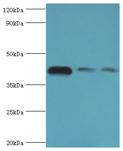 ACTR1A / Centractin Antibody - Western blot. All lanes: Alpha-centractin antibody at 8 ug/ml. Lane 1: mouse brain tissue. Lane 2: MCF-7 whole cell lysate. Lane 3: mouse liver tissue. Secondary antibody: Goat polyclonal to rabbit at 1:10000 dilution. Predicted band size: 43 kDa. Observed band size: 43 kDa.