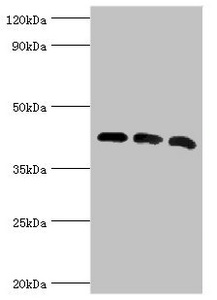 ACTR1A / Centractin Antibody - Western blot All lanes: Alpha-centractin antibody at 8µg/ml Lane 1: Mouse brain tissue Lane 2: MCF-7 whole cell lysate Lane 3: Mouse liver tissue Secondary Goat polyclonal to rabbit IgG at 1/10000 dilution Predicted band size: 43 kDa Observed band size: 43 kDa