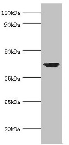 ACTR1A / Centractin Antibody - Western blot All lanes: Alpha-centractin antibody at 7µg/ml + Mouse brain tissue Secondary Goat polyclonal to rabbit IgG at 1/10000 dilution Predicted band size: 43 kDa Observed band size: 43 kDa