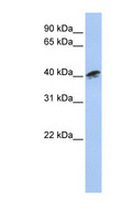ACTR1A / Centractin Antibody - ACTR1A antibody Western blot of MCF7 cell lysate. This image was taken for the unconjugated form of this product. Other forms have not been tested.