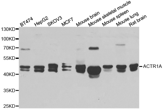ACTR1A / Centractin Antibody - Western blot analysis of extracts of various cell lines.