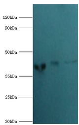 ACTR2 / ARP2 Antibody - Western blot. All lanes: Actin-related protein 2 antibody at 3 ug/ml. Lane 1: mouse spleen tissue. Lane 2: Jurkat whole cell lysate. Lane 3: MCF7 whole cell lysate. secondary Goat polyclonal to rabbit at 1:10000 dilution. Predicted band size: 45 kDa. Observed band size: 45 kDa.