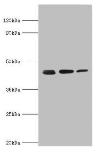 ACTR2 / ARP2 Antibody - Western blot All lanes: Actin-related protein 2 antibody at 3µg/ml Lane 1: Mouse spleen tissue Lane 2: Jurkat whole cell lysate Lane 3: MCF-7 whole cell lysate Secondary Goat polyclonal to rabbit IgG at 1/10000 dilution Predicted band size: 45, 46 kDa Observed band size: 45 kDa