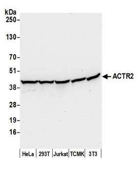 ACTR2 / ARP2 Antibody - Detection of human and mouse ACTR2 by western blot. Samples: Whole cell lysate (50 µg) from HeLa, HEK293T, Jurkat, mouse TCMK-1, and mouse NIH 3T3 cells prepared using NETN lysis buffer. Antibody: Affinity purified rabbit anti-ACTR2 antibody used for WB at 0.1 µg/ml. Detection: Chemiluminescence with an exposure time of 10 seconds.