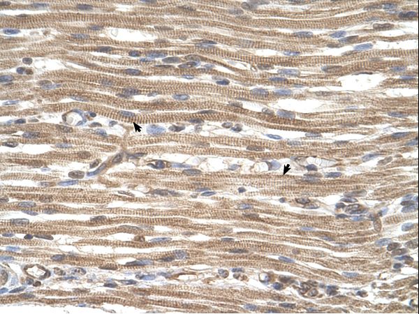 ACTR2 / ARP2 Antibody - ACTR2 / ARP2 antibody ACTR2(ARP2 actin-related protein 2 homolog (yeast)) Antibody was used in IHC to stain formalin-fixed, paraffin-embedded human muscle.  This image was taken for the unconjugated form of this product. Other forms have not been tested.