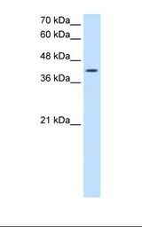 ACTR2 / ARP2 Antibody - Jurkat cell lysate. Antibody concentration: 2.5 ug/ml. Gel concentration: 12%.  This image was taken for the unconjugated form of this product. Other forms have not been tested.