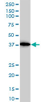 ACTR2 / ARP2 Antibody - ACTR2 monoclonal antibody (M01), clone 1B10-C4. Western blot of ACTR2 expression in A-431.