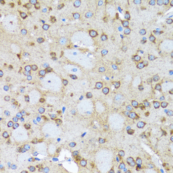 ACTR2 / ARP2 Antibody - Immunohistochemistry of paraffin-embedded rat brain tissue.