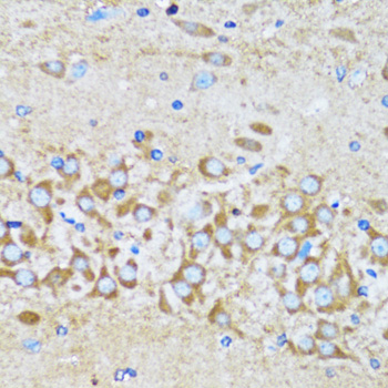 ACTR2 / ARP2 Antibody - Immunohistochemistry of paraffin-embedded mouse brain tissue.