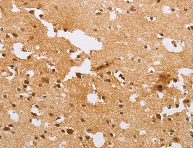 ACTR2 / ARP2 Antibody - Immunohistochemistry of paraffin-embedded Human brain using ACTR2 Polyclonal Antibody at dilution of 1:40.