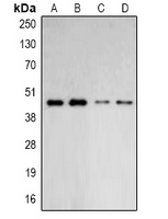 ACTR2 / ARP2 Antibody - Western blot analysis of ARP2 expression in HepG2 (A); HeLa (B); mouse lung (C); mouse brain (D) whole cell lysates.