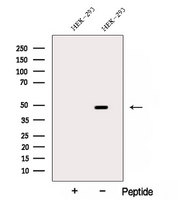 ACTR2 / ARP2 Antibody - Western blot analysis of extracts of HEK293 cells using ARP2 antibody. The lane on the left was treated with blocking peptide.