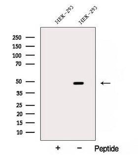 ACTR2 / ARP2 Antibody - Western blot analysis of extracts of HEK293 cells using ARP2 antibody. The lane on the left was treated with blocking peptide.