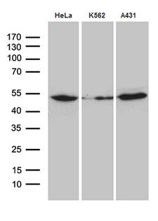ACTR3 Antibody - Western blot analysis of extracts. (35ug) from 3 cell lines by using anti-ACTR3 monoclonal antibody. (1:500)