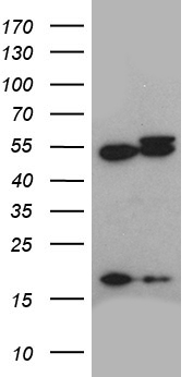 ACTR3 Antibody - HEK293T cells were transfected with the pCMV6-ENTRY control. (Left lane) or pCMV6-ENTRY ACTR3. (Right lane) cDNA for 48 hrs and lysed