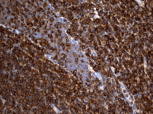 ACTR3 Antibody - Immunohistochemical staining of paraffin-embedded Human tonsil within the normal limits using anti-ACTR3 mouse monoclonal antibody. (Heat-induced epitope retrieval by 1mM EDTA in 10mM Tris buffer. (pH8.5) at 120°C for 3 min. (1:2000)