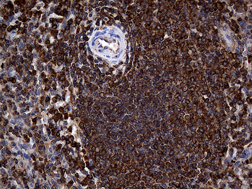 ACTR3 Antibody - Immunohistochemical staining of paraffin-embedded Human spleen tissue within the normal limits using anti-ACTR3 mouse monoclonal antibody. (Heat-induced epitope retrieval by 1mM EDTA in 10mM Tris buffer. (pH8.5) at 120°C for 3 min. (1:2000)