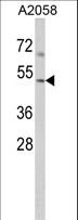 ACTR3 Antibody - Western blot of ACTR3 Antibody in A2058 cell line lysates (35 ug/lane). ACTR3 (arrow) was detected using the purified antibody.