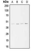 ACTR3 Antibody - Western blot analysis of ARP3 expression in A549 (A); Jurkat (B); HeLa (C); A431 (D) whole cell lysates.