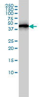 ACTR3 Antibody - ACTR3 monoclonal antibody (M02), clone 2B6 Western blot of ACTR3 expression in A-431.