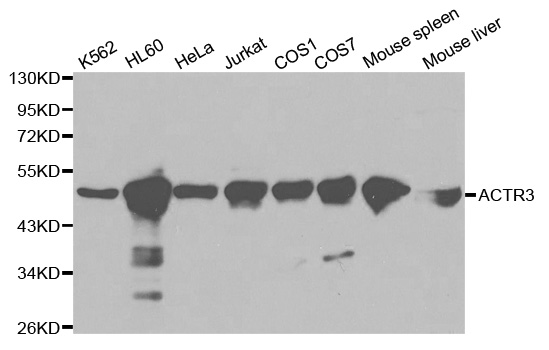 ACTR3 Antibody - Western blot analysis of extracts of various cell lines.