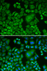 ACTR3 Antibody - Immunofluorescence analysis of HeLa cells using ACTR3 antibody. Blue: DAPI for nuclear staining.
