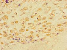 ACTR3 Antibody - Immunohistochemistry of paraffin-embedded human placental tissue using ACTR3 Antibody at dilution of 1:100