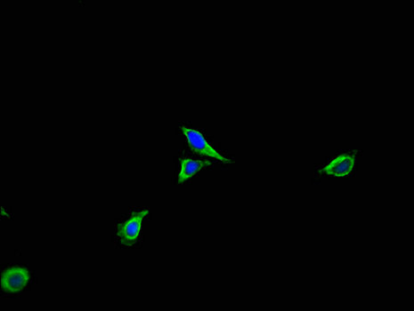 ACTR3 Antibody - Immunofluorescent analysis of Hela cells using ACTR3 Antibody at a dilution of 1:100 and Alexa Fluor 488-congugated AffiniPure Goat Anti-Rabbit IgG(H+L)