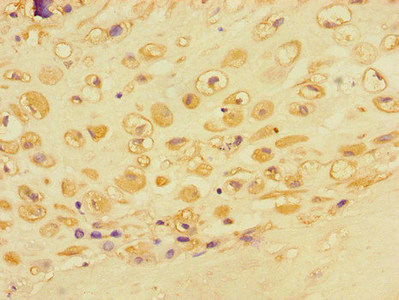 ACTR3 Antibody - Immunohistochemistry of paraffin-embedded human placental tissue using ACTR3 Antibody at dilution of 1:100