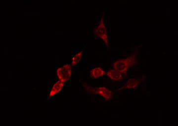 ACTR3 Antibody - Staining HeLa cells by IF/ICC. The samples were fixed with PFA and permeabilized in 0.1% Triton X-100, then blocked in 10% serum for 45 min at 25°C. The primary antibody was diluted at 1:200 and incubated with the sample for 1 hour at 37°C. An Alexa Fluor 594 conjugated goat anti-rabbit IgG (H+L) antibody, diluted at 1/600, was used as secondary antibody.