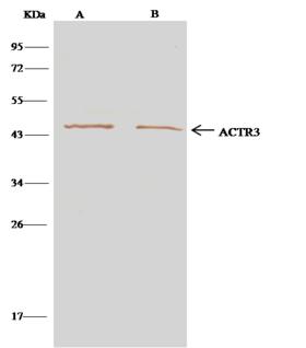 ACTR3 Antibody - ACTR3 was immunoprecipitated using: Lane A: 0.5 mg K562 Whole Cell Lysate. Lane B: 0.5 mg Hela Whole Cell Lysate. 4 uL anti-ACTR3 rabbit polyclonal antibody and 15 ul of 50% Protein G agarose. Primary antibody: Anti-ACTR3 rabbit polyclonal antibody, at 1:100 dilution. Secondary antibody: Clean-Blot IP Detection Reagent (HRP) at 1:500 dilution. Developed using the DAB staining technique. Performed under reducing conditions. Predicted band size: 47 kDa. Observed band size: 47 kDa.