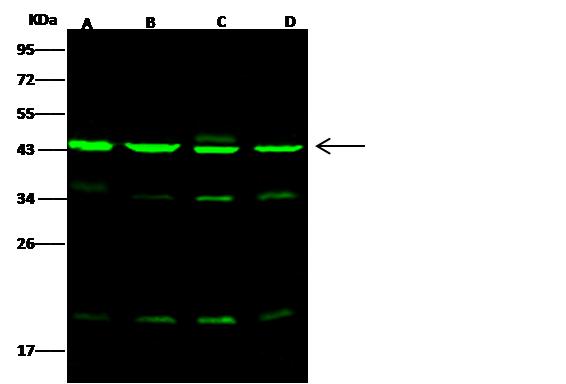 ACTR3 Antibody - Anti-ACTR3 rabbit polyclonal antibody at 1:500 dilution. Lane A: HeLa Whole Cell Lysate. Lane B: Jurkat Whole Cell Lysate. Lane C: A549 Whole Cell Lysate. Lane D: K562 Whole Cell Lysate. Lysates/proteins at 30 ug per lane. Secondary: Goat Anti-Rabbit IgG H&L (Dylight 800) at 1/10000 dilution. Developed using the Odyssey technique. Performed under reducing conditions. Predicted band size: 47 kDa. Observed band size: 45 kDa. (We are unsure as to the identity of these extra bands.)