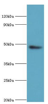 ACTR3B / ARP4 Antibody - Western blot. All lanes: Actin-related protein 3B antibody at 8 ug/ml+HepG2 whole cell lysate. Secondary antibody: Goat polyclonal to rabbit at 1:10000 dilution. Predicted band size: 48 kDa. Observed band size: 48 kDa Immunohistochemistry.