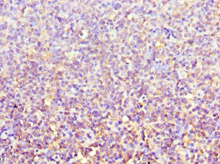 ACTR3B / ARP4 Antibody - Immunohistochemistry of paraffin-embedded human tonsil tissue using ACTR3B Antibody at dilution of 1:100