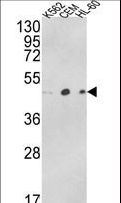 ACTR3B / ARP4 Antibody - Western blot of ACTR3B Antibody in K562, CEM, HL-60 cell line lysates (35 ug/lane). ACTR3B (arrow) was detected using the purified antibody.