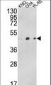 ACTR3B / ARP4 Antibody - Western blot of ACTR3B Antibody in K562, CEM, HL-60 cell line lysates (35 ug/lane). ACTR3B (arrow) was detected using the purified antibody.