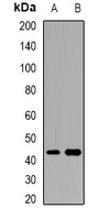 ACTR3B / ARP4 Antibody - Western blot analysis of ARP3-beta expression in HeLa (A); mouse brain (B) whole cell lysates.