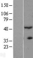 ACTR3B / ARP4 Protein - Western validation with an anti-DDK antibody * L: Control HEK293 lysate R: Over-expression lysate